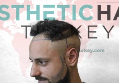 Esthetic Hair Turkey