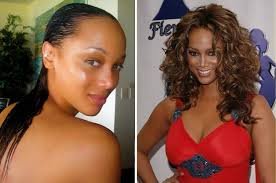 El antes y el después del implante capilar de Tyra Banks